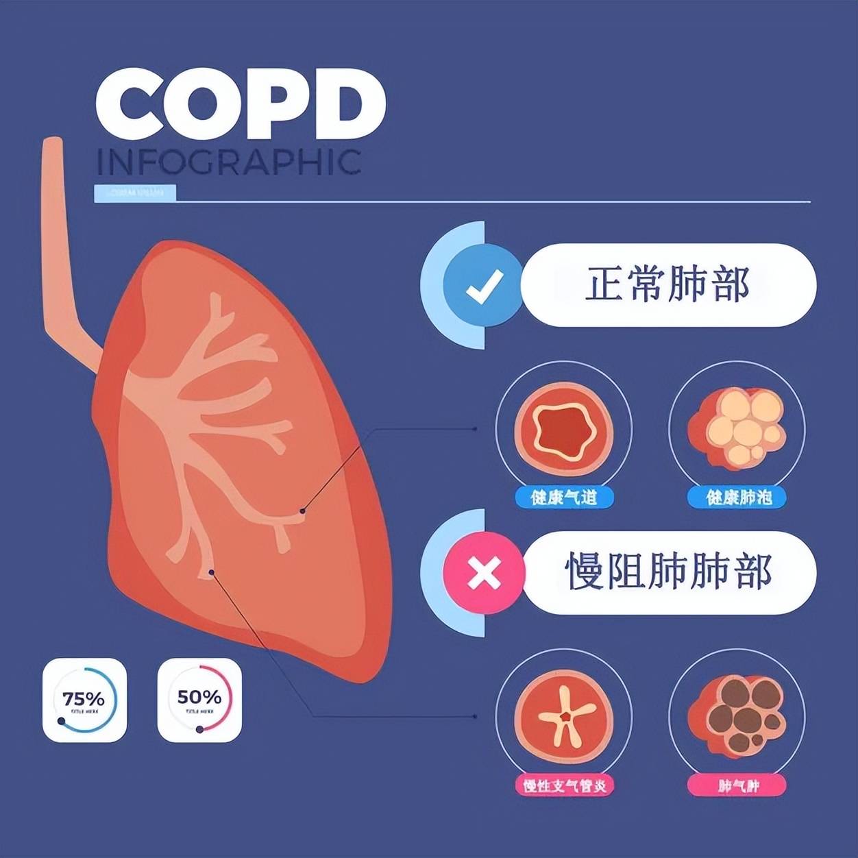 慢阻肺最新三联药物论述，种类与治疗效果解析