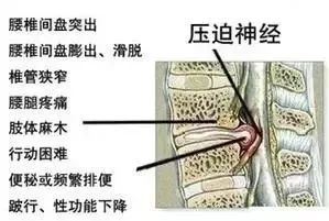 脊髓损伤最新突破成果及其温馨故事概述